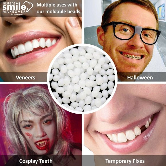 16 Packs of Instant Smile Fitting Beads & Case - Picture 4 of 5